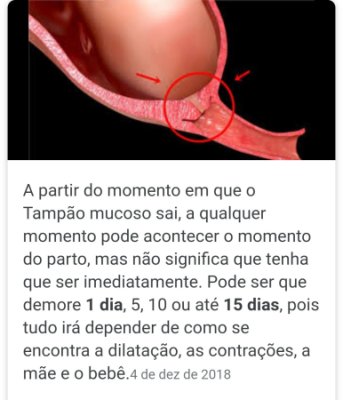 depois que sai o tampao demora pro bebe nascer