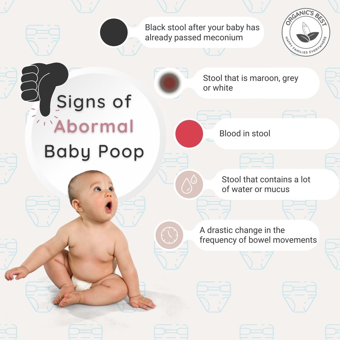 Why Is My Newborn Not Pooping? Tips for Concerned Parents